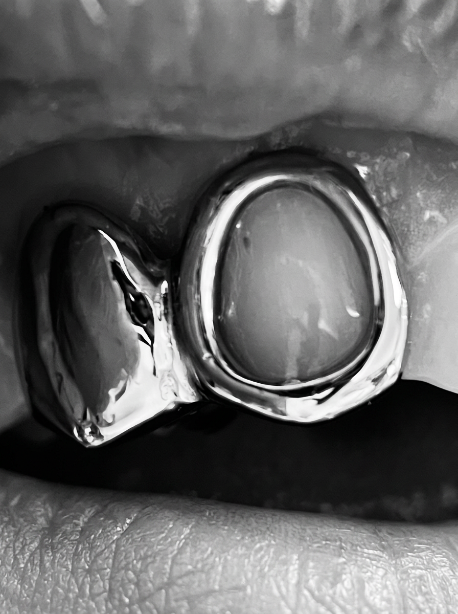Custom grillz: Open face · polished