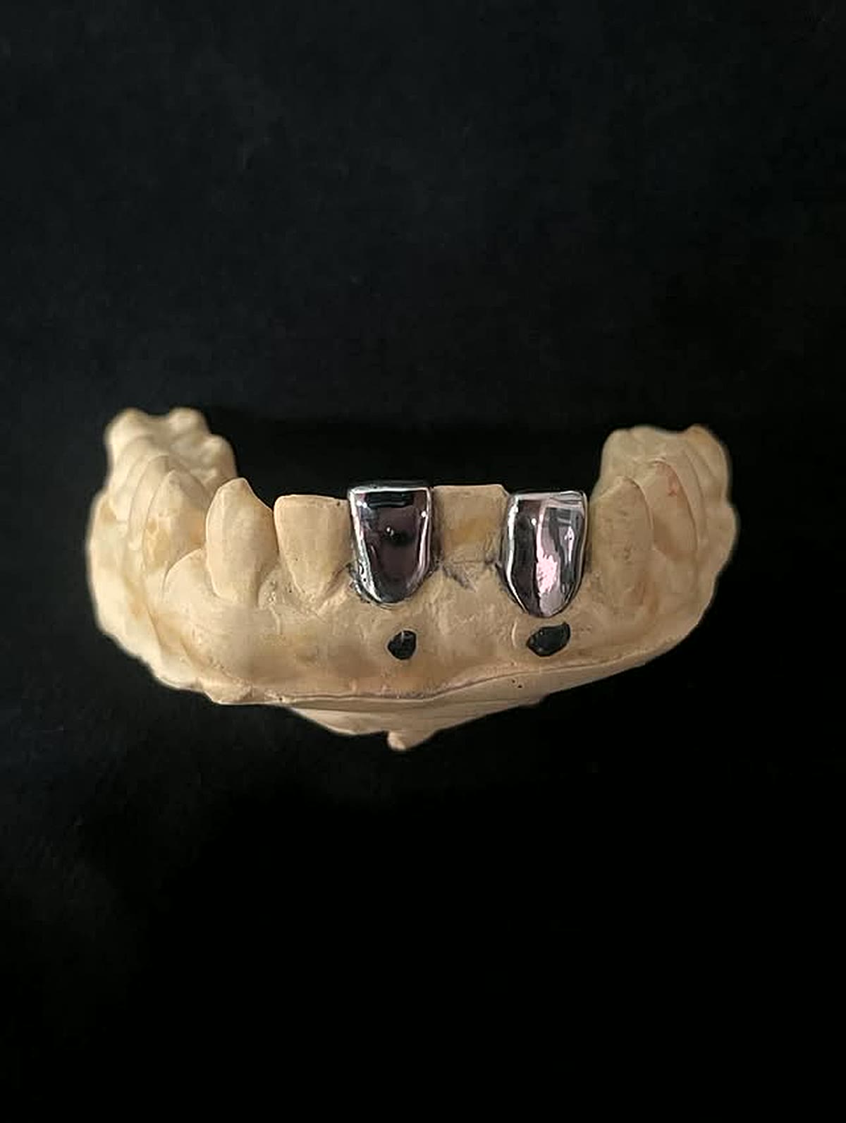Two custom silver grillz caps fitted on a dental stone cast in the workshop
